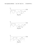 APPARATUS AND METHOD FOR WOUND TREATMENT EMPLOYING PERIODIC     SUB-ATMOSPHERIC PRESSURE diagram and image