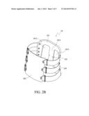 BACK BRACE TYPE SURGERY POSITIONING APPARATUS AND NAVIGATION SYSTEM HAVING     THE SAME diagram and image