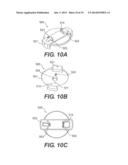 Medicament Delivery Systems diagram and image