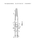 DIRECT STREAM HYDRODYNAMIC CATHETER SYSTEM diagram and image