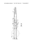 DIRECT STREAM HYDRODYNAMIC CATHETER SYSTEM diagram and image