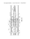 DIRECT STREAM HYDRODYNAMIC CATHETER SYSTEM diagram and image