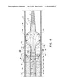 DIRECT STREAM HYDRODYNAMIC CATHETER SYSTEM diagram and image