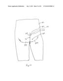 WOUND BARRIER PAD diagram and image