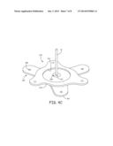 MEDICAL DEVICE ANCHORING APPARATUS AND METHODS diagram and image