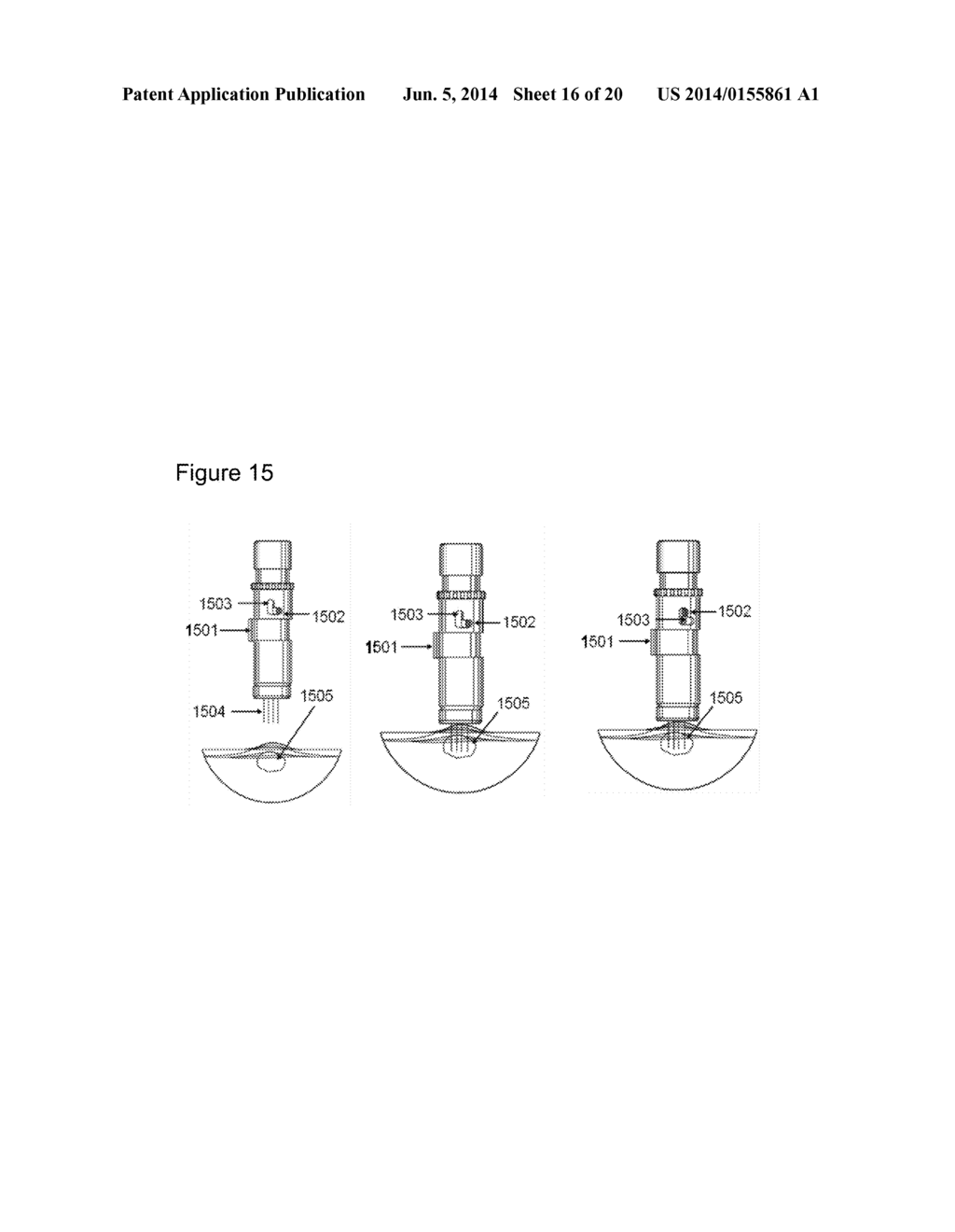 EXTRUSION METHODS AND DEVICES FOR DRUG DELIVERY - diagram, schematic, and image 17