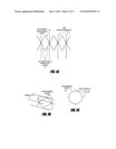 METHODS AND APPARATUS FOR INTRODUCING TUMESCENT FLUID TO BODY TISSUE diagram and image