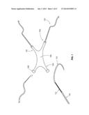 SYSTEMS AND METHODS FOR STERNUM REPAIR diagram and image