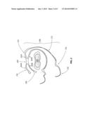 SYSTEMS AND METHODS FOR STERNUM REPAIR diagram and image