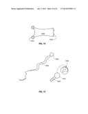 SYSTEMS AND METHODS FOR STERNUM REPAIR diagram and image