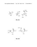 SYSTEMS AND METHODS FOR STERNUM REPAIR diagram and image