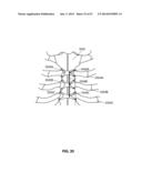 SYSTEMS AND METHODS FOR STERNUM REPAIR diagram and image