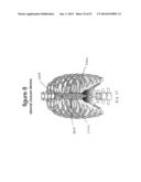 SYSTEMS AND METHODS FOR STERNUM REPAIR diagram and image