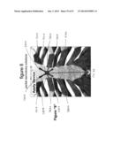 SYSTEMS AND METHODS FOR STERNUM REPAIR diagram and image