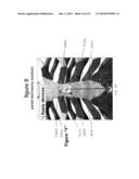 SYSTEMS AND METHODS FOR STERNUM REPAIR diagram and image