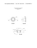 SYSTEMS AND METHODS FOR STERNUM REPAIR diagram and image