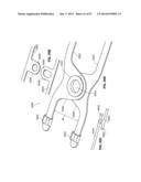 SYSTEMS AND METHODS FOR STERNUM REPAIR diagram and image