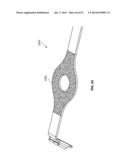 SYSTEMS AND METHODS FOR STERNUM REPAIR diagram and image