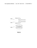 SYSTEMS AND METHODS FOR STERNUM REPAIR diagram and image