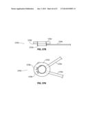 SYSTEMS AND METHODS FOR STERNUM REPAIR diagram and image