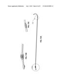 SYSTEMS AND METHODS FOR STERNUM REPAIR diagram and image