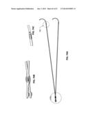 SYSTEMS AND METHODS FOR STERNUM REPAIR diagram and image