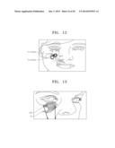 METHOD OF IMPROVING ELASTICITY OF TISSUE OF LIVING BODY diagram and image