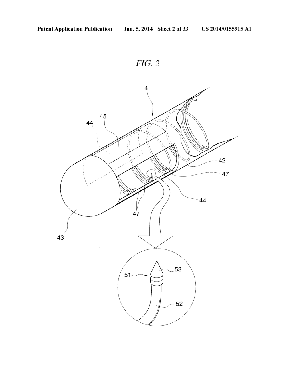 GASTRIC THERAPY SYSTEM AND METHOD FOR SUTURING GASTRIC WALL - diagram, schematic, and image 03