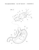 GASTRIC THERAPY SYSTEM AND METHOD FOR SUTURING GASTRIC WALL diagram and image