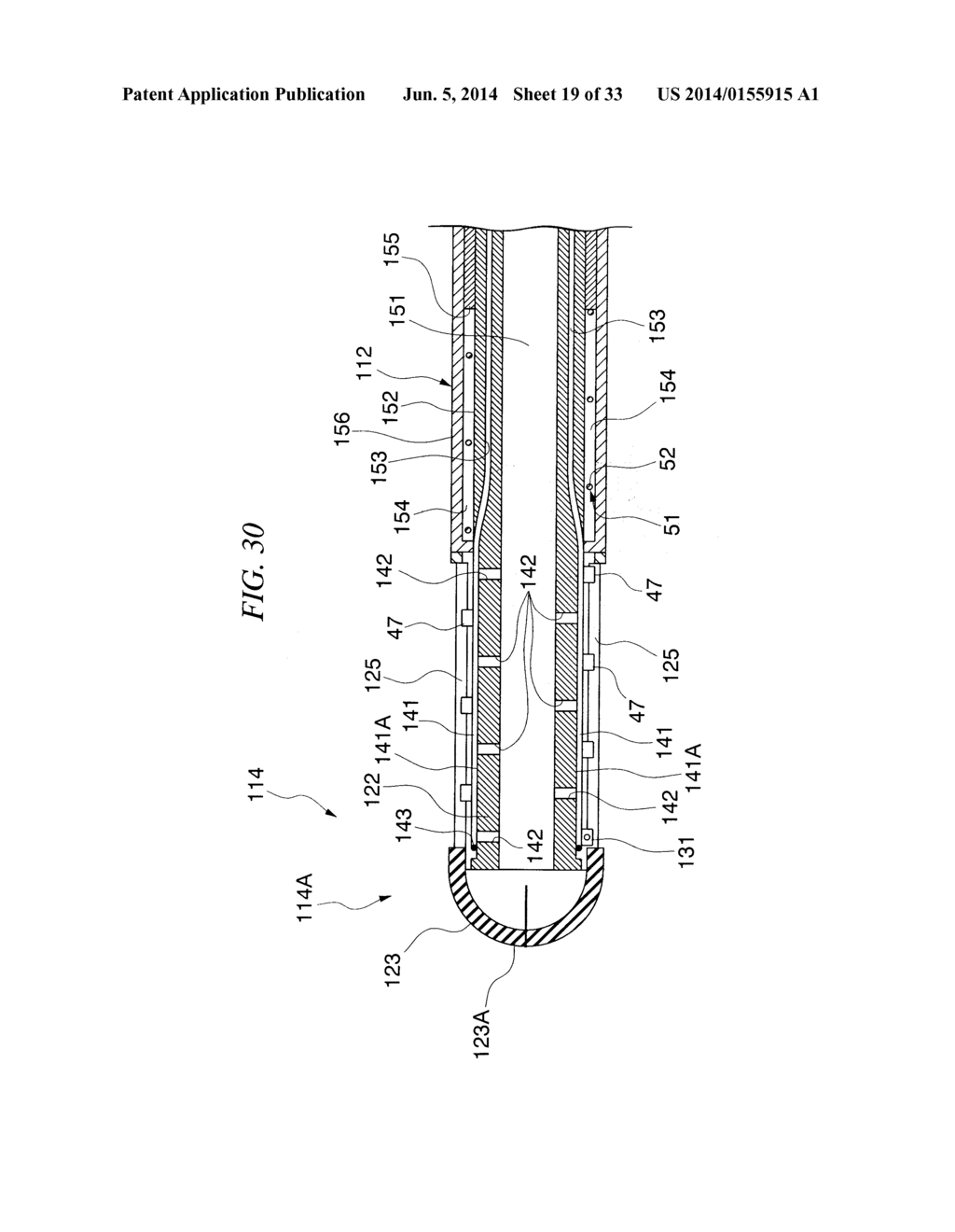 GASTRIC THERAPY SYSTEM AND METHOD FOR SUTURING GASTRIC WALL - diagram, schematic, and image 20