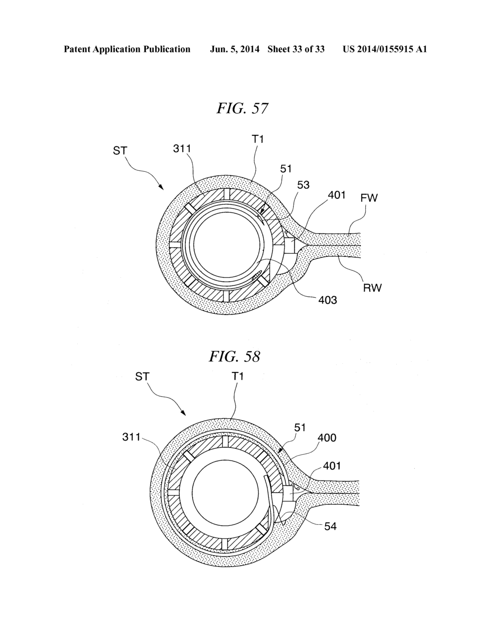 GASTRIC THERAPY SYSTEM AND METHOD FOR SUTURING GASTRIC WALL - diagram, schematic, and image 34