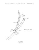 Methods And Devices For Performing Gastroplasty diagram and image