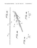 CUTTING WIRE ASSEMBLY FOR USE WITH A CATHETER diagram and image