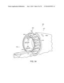 ERGONOMIC SURGICAL INSTRUMENTS diagram and image