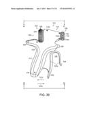 ERGONOMIC SURGICAL INSTRUMENTS diagram and image