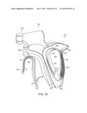 ERGONOMIC SURGICAL INSTRUMENTS diagram and image