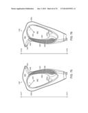 ERGONOMIC SURGICAL INSTRUMENTS diagram and image