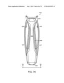 ERGONOMIC SURGICAL INSTRUMENTS diagram and image