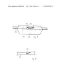 INFERIOR FILTER RETRIEVAL DEVICE diagram and image