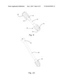 BONE IMPLANT diagram and image