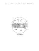 OPTICAL FIBER-FINE WIRE LEAD FOR ELECTROSTIMULATION AND SENSING diagram and image