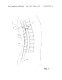 TISSUE-CAPTURED ANCHORS AND METHODS OF USE diagram and image