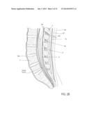 TISSUE-CAPTURED ANCHORS AND METHODS OF USE diagram and image