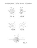 TISSUE-CAPTURED ANCHORS AND METHODS OF USE diagram and image