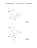 TISSUE-CAPTURED ANCHORS AND METHODS OF USE diagram and image