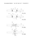 TISSUE-CAPTURED ANCHORS AND METHODS OF USE diagram and image