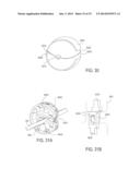 TISSUE-CAPTURED ANCHORS AND METHODS OF USE diagram and image