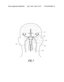 EXPANDABLE TIP ASSEMBLY FOR THROMBUS MANAGEMENT diagram and image