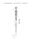 EXPANDABLE TIP ASSEMBLY FOR THROMBUS MANAGEMENT diagram and image