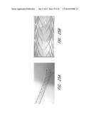 EXPANDABLE TIP ASSEMBLY FOR THROMBUS MANAGEMENT diagram and image